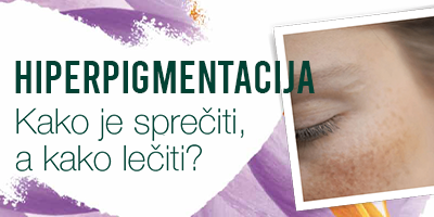 Hiperpigmentacija – kako je sprečiti, a kako lečiti?